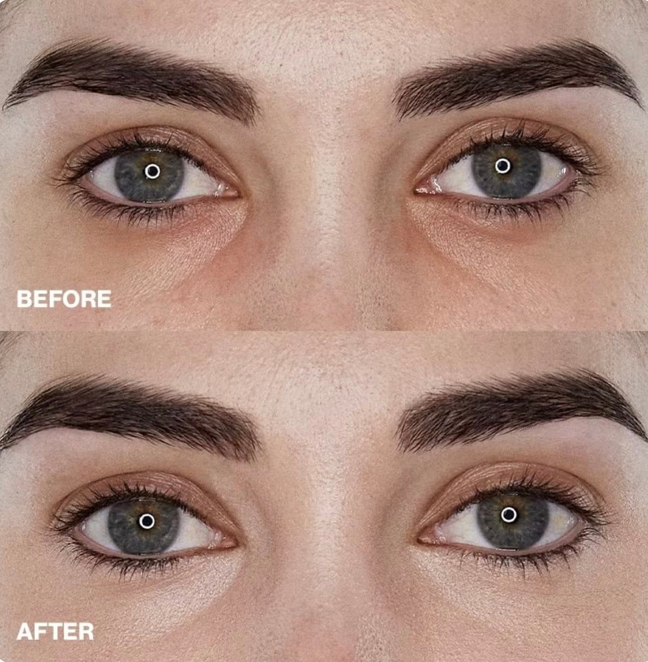 MD EYE STICK- Contorno de ojos con colágeno y extracto de caracol