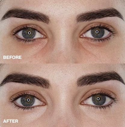 MD EYE STICK- Contorno de ojos con colágeno y extracto de caracol