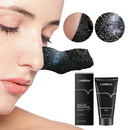 LANBENA BLACK MASK BY MD SKINCARE